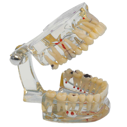 Hager Werken® Study Model Transparent Plus