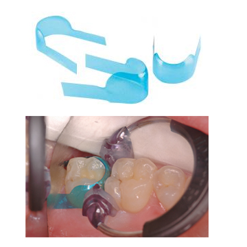  Composi-Tight Clear 6,8mm molar, 100st