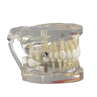 Tandmodell M4019-2 - 2