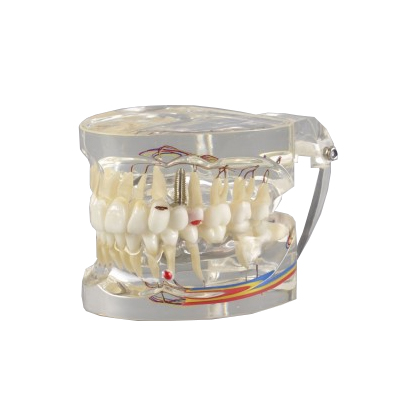 Tandmodell M4019-2