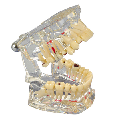Hager Werken® Study Model Transparent De Luxe