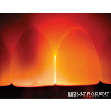 VALO TransLume Lenses 2st. - 3