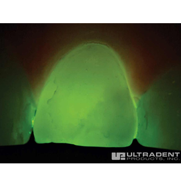 VALO TransLume Lenses 2st. - 2