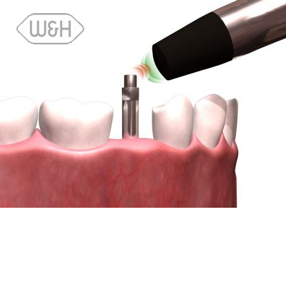 Osstel® ISQ Probe - 2