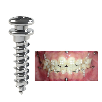 Dual Top Mini Screw JK, 1St.