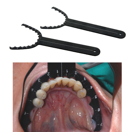 Implantat Universal Guide, 1par.