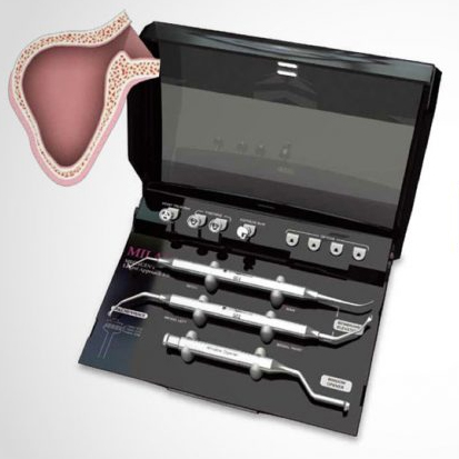 MILA kit® Lateral Approach Kit