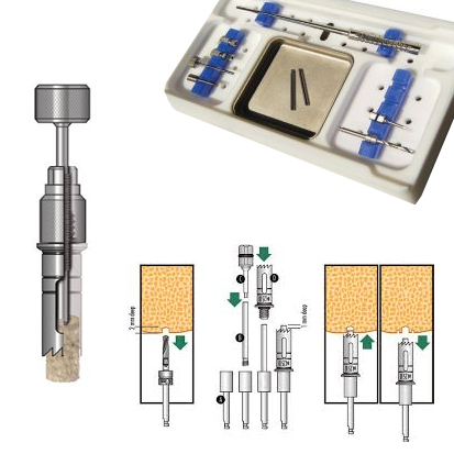 ACE® Two Piece Trephine Kit with Positive Stops 