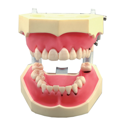 Dental Model M4024 Parodontology