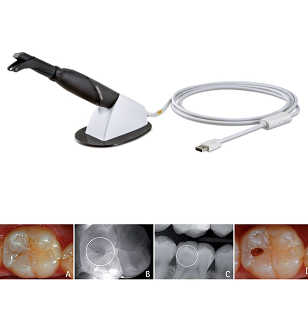 KaVo DIAGNOcam 2170