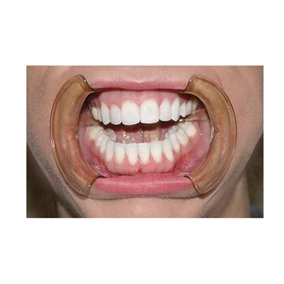 Munvinkelhållare Medium Cheek Retractor, 2st