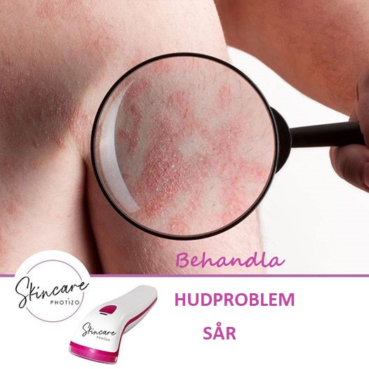 Photizo Skin Care LED-ljusterapi/LED-LLLT - 4