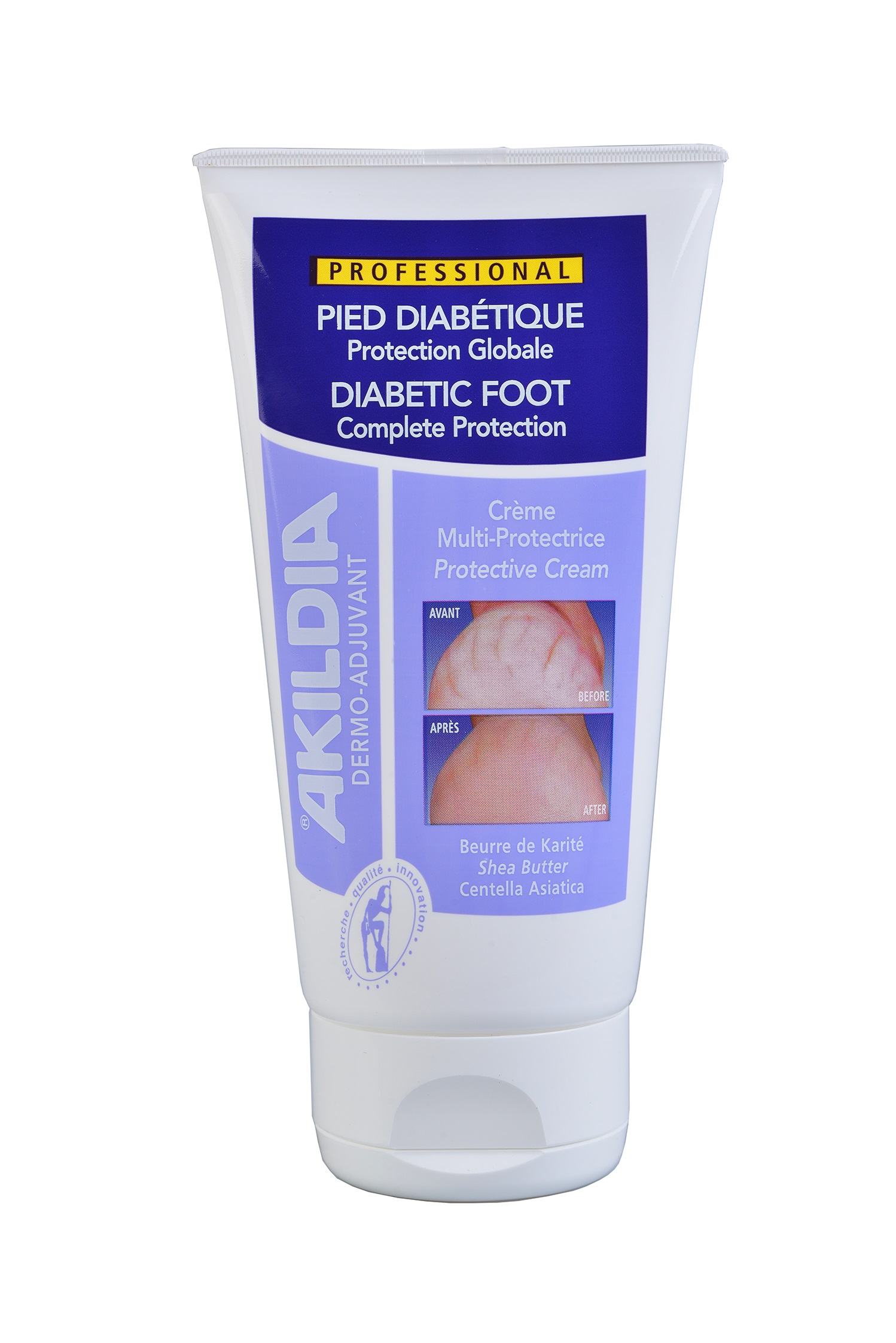 Akileine Akildia - 150 ml - Diabetesfoten - 2