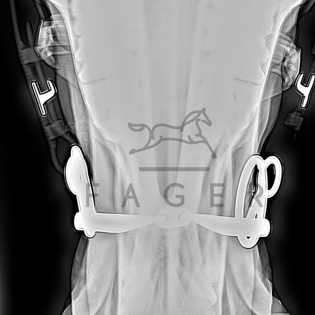 FAGER CARL TITAN LOOSE RINGS - 6