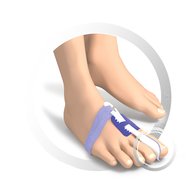 RUCK® AVLASTNING Basic Hallux Valgus Nattbandage, storlek 34-36 (höger, 1 st)