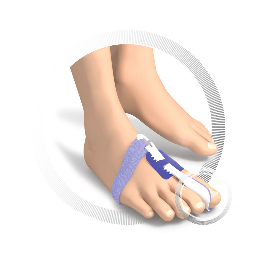 RUCK® AVLASTNING Basic Hallux Valgus Nattbandage, storlek 41-46 (höger, 1 st) - 2