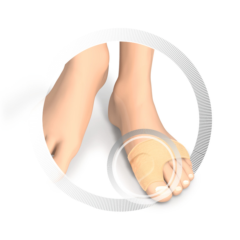 RUCK® AVLASTNING smartgel Hallux Valgus-skydd (stor, 2 st) - 4