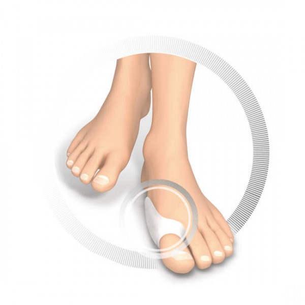 RUCK® AVLASTNING Silikon, Hallux-Valgus skydd, 2 st - 2