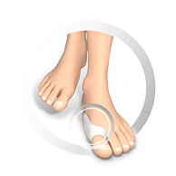 RUCK® AVLASTNING Silikon, Hallux-Valgus skydd, 10 st