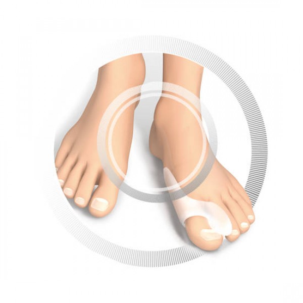 RUCK® AVLASTNING Smartgel, Stortåspridare med Hallux-Valgus skydd, 10 st - STORPACK! - 2