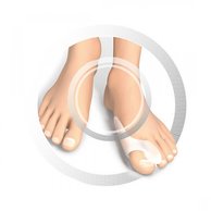 RUCK® AVLASTNING Smartgel, Stortåspridare med Hallux-Valgus skydd, 10 st - STORPACK!
