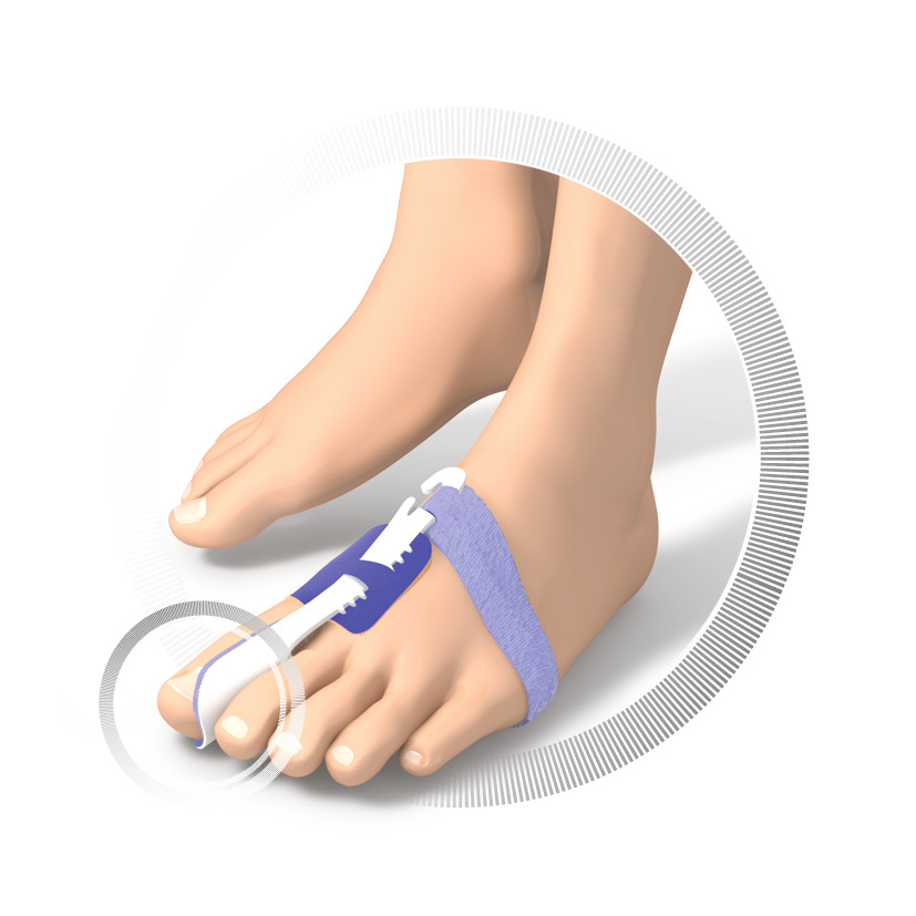 RUCK® AVLASTNING Basic Hallux Valgus Nattbandage, storlek 34-36 (vänster, 1 st) - 3