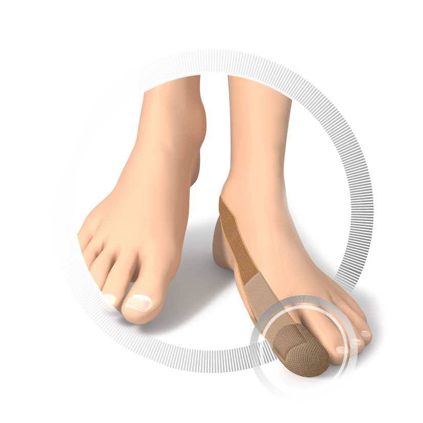 RUCK® AVLASTNING Basic, Hallux Valgus-bandage, str 34-42, 1 st - 3