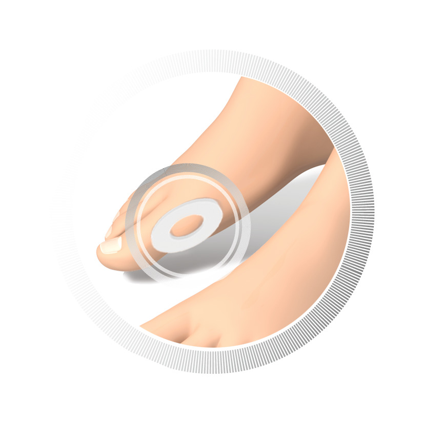 RUCK® AVLASTNING Basic Hallux Valgus-ring, rund (4 styck) - 3