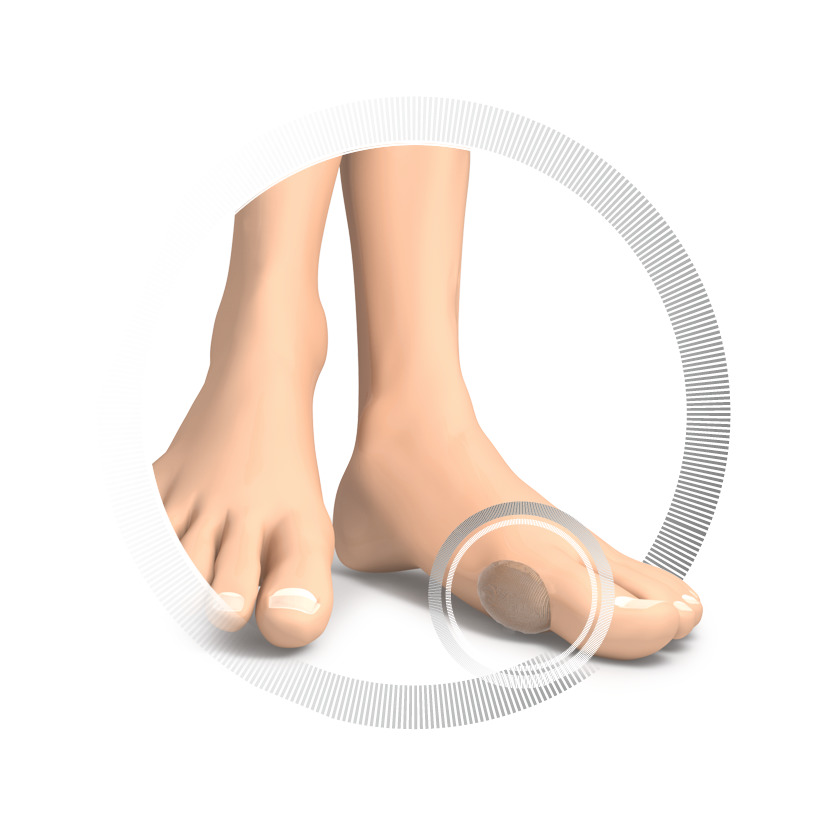 RUCK® AVLASTNING Smartgel, Avlastningsplåster - oval, 2 st - 3
