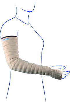 Mobiderm Arm med hand MTM (måttillverkat)
