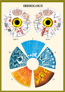 Irisdiagnostik, inplastad dubbelsidig A4