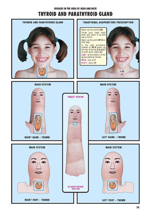 Su Jok and Moxa, a self-treatment manual - 2