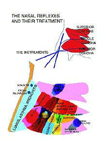 The Nasal Reflexes and their teatment, Näsans reflexzoner, dubbelsidig  A5 från van Baaarle