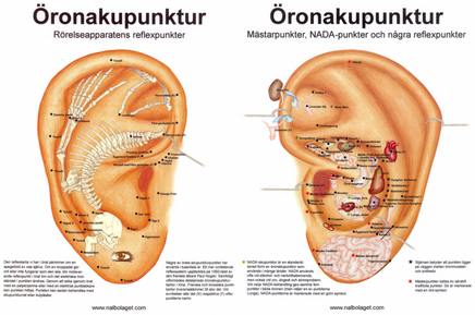 Öronakupunktur, bokformat