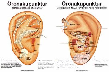 Öronakupunktur, bokformat