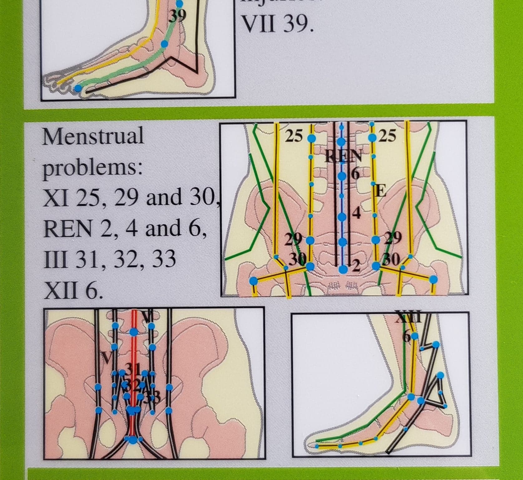 Moxibustion- Moxa, Dubbel 2-sidig A4, engelsk eller fransk text - 2
