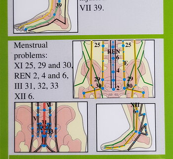 Moxibustion- Moxa, Dubbel 2-sidig A4, engelsk eller fransk text