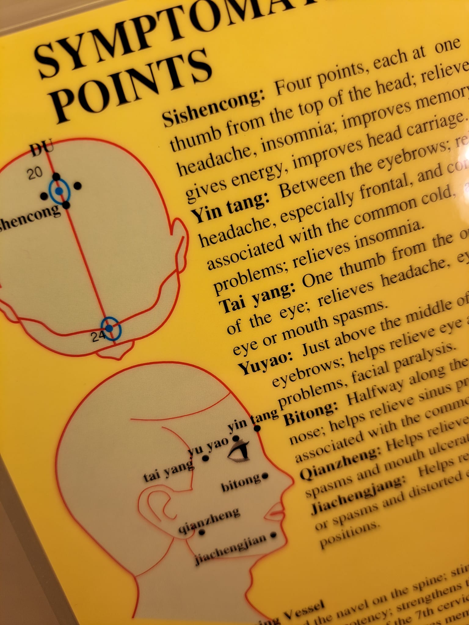Symptomatic Acupuncture Points-Symtomatiska Akupunkturpunkter, Dubbelsidig A4 - 2