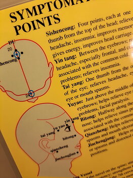 Symptomatic Acupuncture Points-Symtomatiska Akupunkturpunkter, Dubbelsidig A4