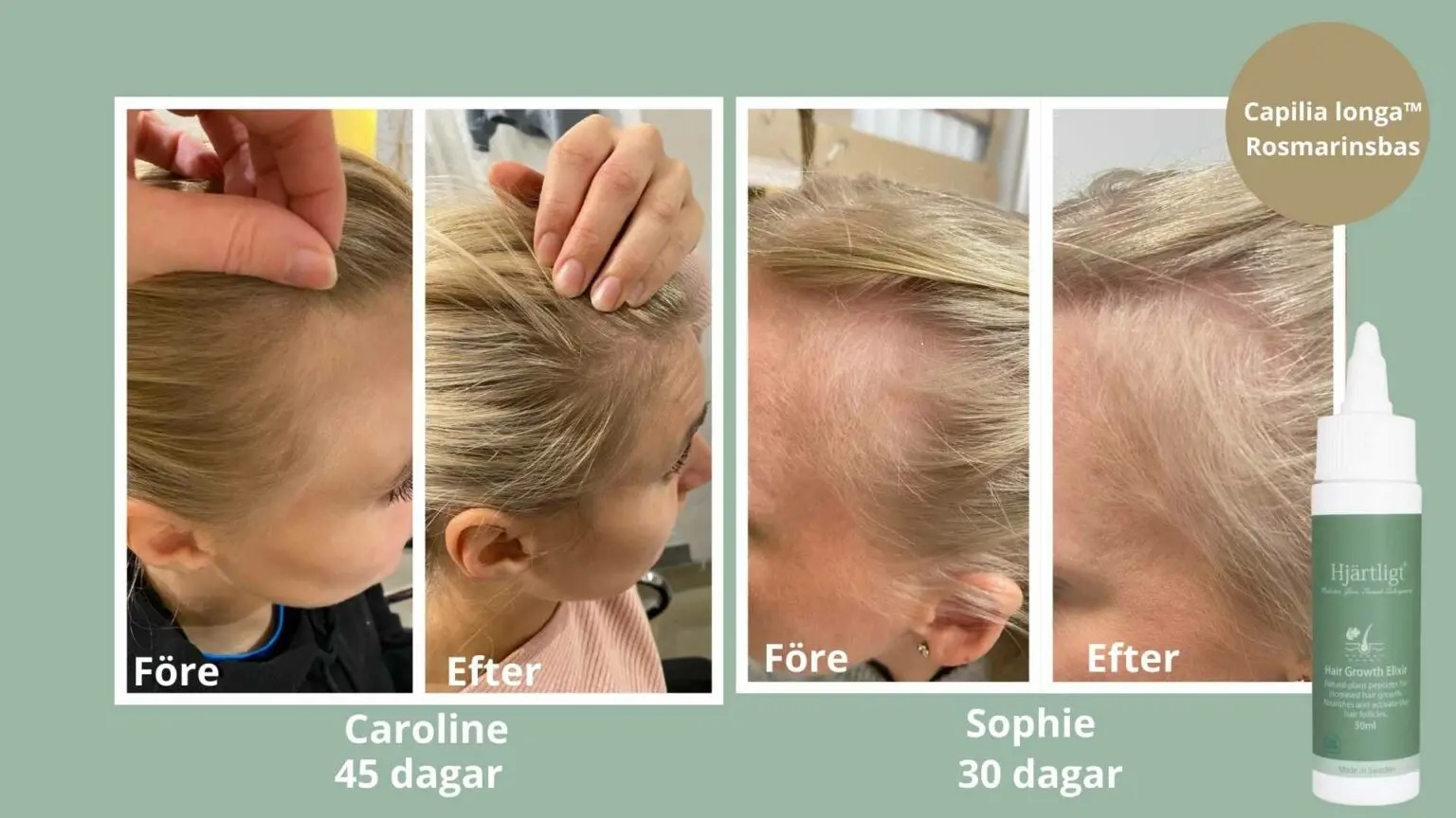 Hjärtligt Hair Growth Elixir - 3